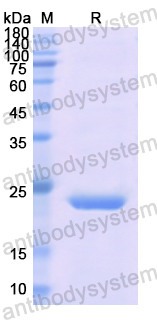 Recombinant Human FTL Protein, N-His