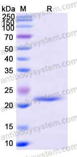 Recombinant Human FTH1 Protein, N-His