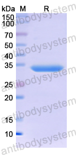 Recombinant Human MT2A Protein, N-GST