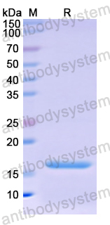 Recombinant Human Osteocalcin/BGLAP/OC Protein, N-His