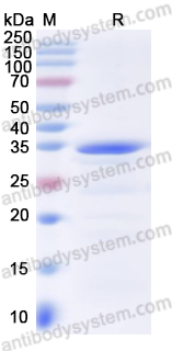 Recombinant Human Osteocalcin/BGLAP/OC Protein, N-GST & C-His