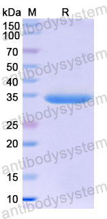 Recombinant Human MT-ND1 Protein, N-GST