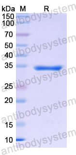 Recombinant Human KLKB1 Protein, N-His