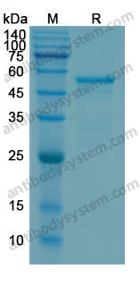 Recombinant Human MMP1 Protein, N-His