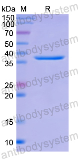 Recombinant Human C4BPA Protein, N-His