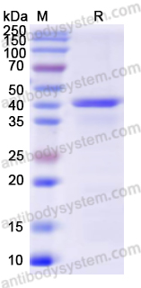 Recombinant Human VTN Protein, N-His