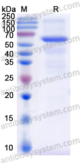 Recombinant Human CAT Protein, N-His