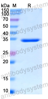 Recombinant Human RAF1 Protein, N-His