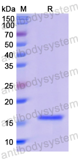 Recombinant Human PLA2G1B Protein, N-His