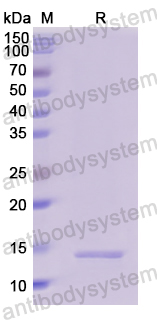 Recombinant Human GBA Protein, N-His
