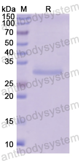 Recombinant Human FUCA1 Protein, N-His