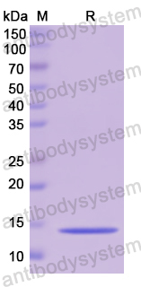 Recombinant Human CSTB Protein, N-His