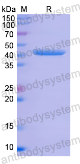 Recombinant Human ANXA1 Protein, N-His