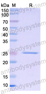 Recombinant Human APOB Protein, N-His