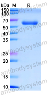 Recombinant Human NR3C1 Protein, N-His