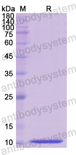 Recombinant Human TFF1 Protein, N-His