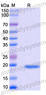 Recombinant Human TFF1 Protein, N-His-SUMO