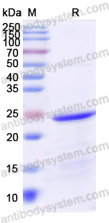 Recombinant Human CD230/PRNP Protein, N-His