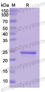 Recombinant Human SOD2 Protein, N-His