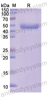 Recombinant Human LCAT Protein, N-His