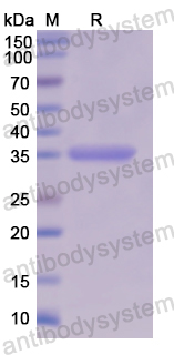 Recombinant Human OAT Protein, N-His