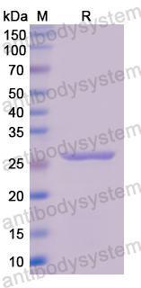 Recombinant Human TK1 Protein, N-His