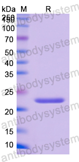 Recombinant Human A1BG Protein, N-His