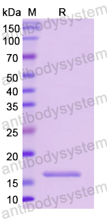 Recombinant Human CD74 Protein, N-His