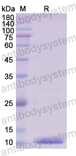 Recombinant Human CD3D Protein, N-His