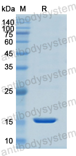 Recombinant Human KRT1 Protein, N-His