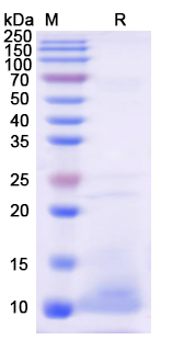 Recombinant Human S100B Protein, N-His