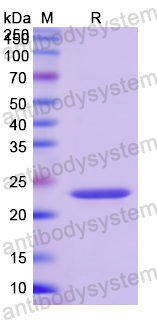 Recombinant Human VWF Protein, N-His