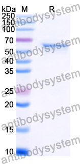 Recombinant Human VWF Protein, N-His-SUMO