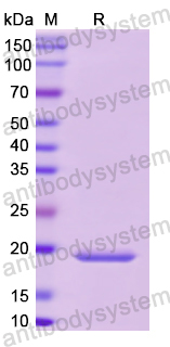 Recombinant Human SHBG Protein, N-His