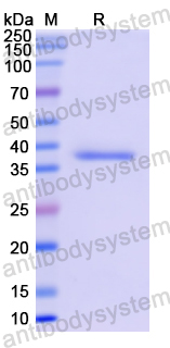 Recombinant Human GAPDH Protein, C-His