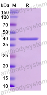 Recombinant Human CD340/ERBB2 Protein, N-His