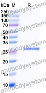 Recombinant Human TP53/p53 Protein, N-His