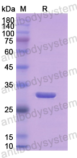 Recombinant Human AMY2A Protein, N-His