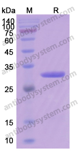 Recombinant Human HSPB1/HSP27 Protein, N-His