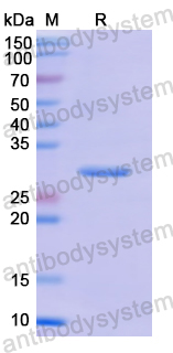 Recombinant Human CYP1A1 Protein, N-His