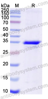 Recombinant Human TYMS Protein, N-His