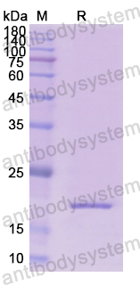 Recombinant Human RPN1 Protein, N-His