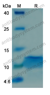 Recombinant Human IGF1 Protein, C-His