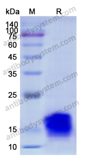 Recombinant Human IGF1 Protein, N-His