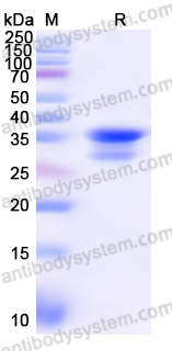 Recombinant Human ATP1A1 Protein, N-His