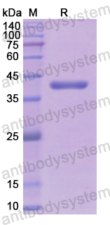 Recombinant Human ALDOB Protein, N-His