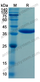 Recombinant Human ARG1 Protein, N-His