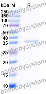 Recombinant Human ARG1/Arginase-1 Protein, C-His