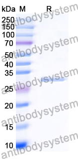 Recombinant Human ARG1/Arginase-1 Protein, C-His