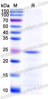 Recombinant Human APOD Protein, N-His